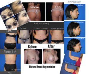 plastic-cosmetic-surgery-before-after-photos